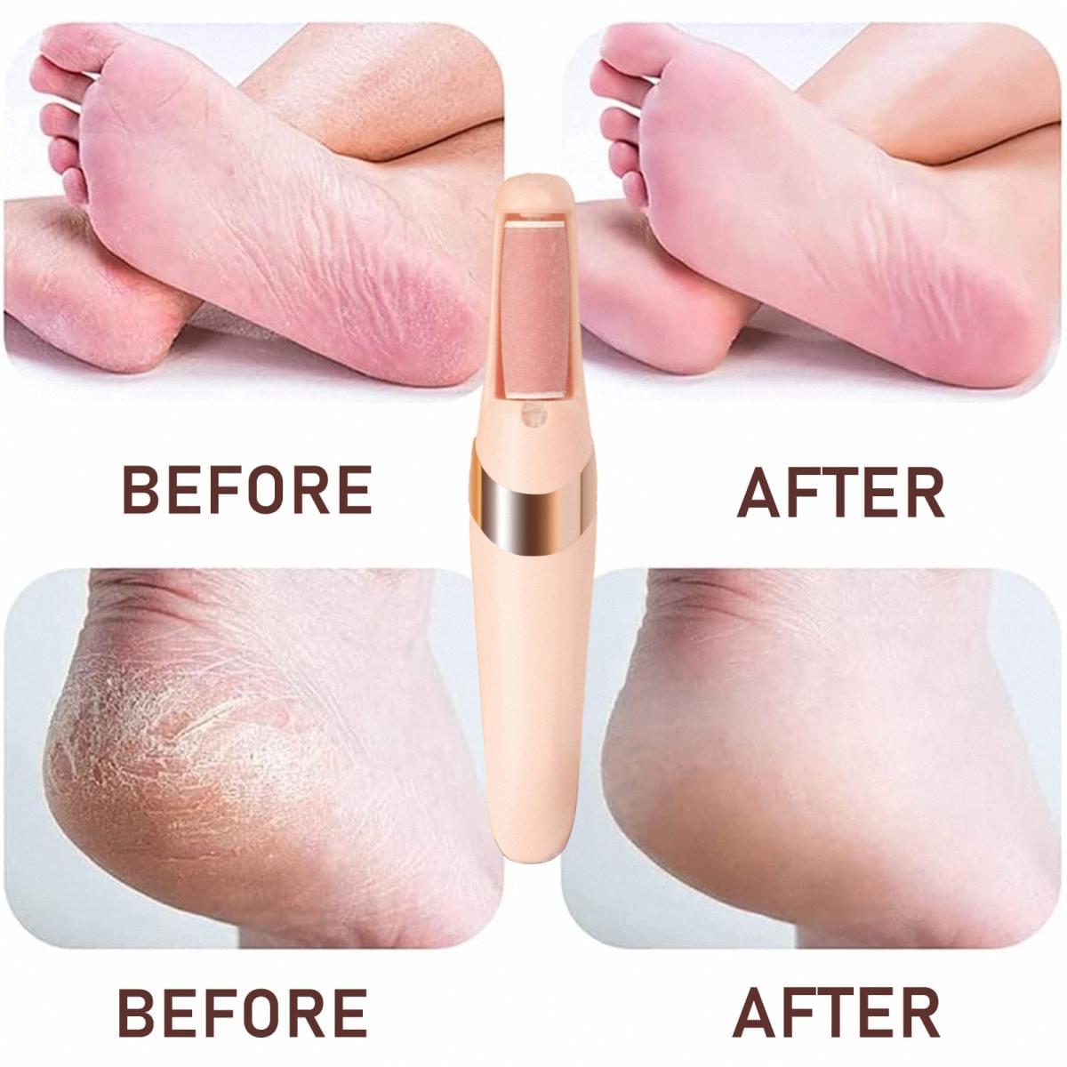 GlowSmoother Pro™