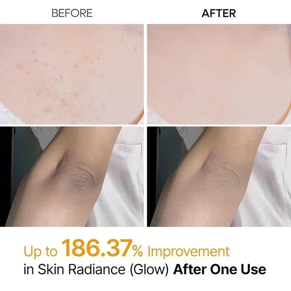Body Peel Exfoliating Spray