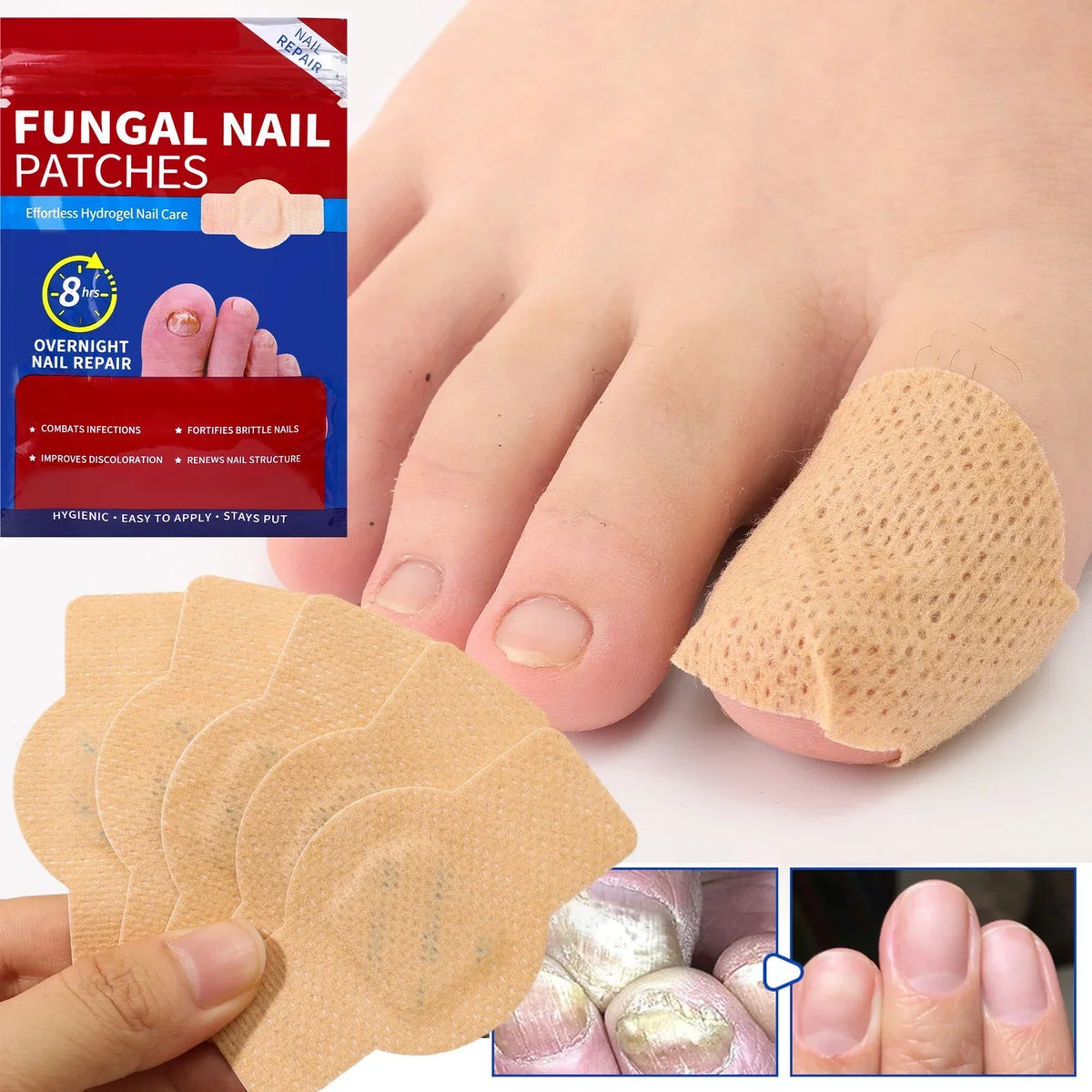 Breathable Toe Protection Patches