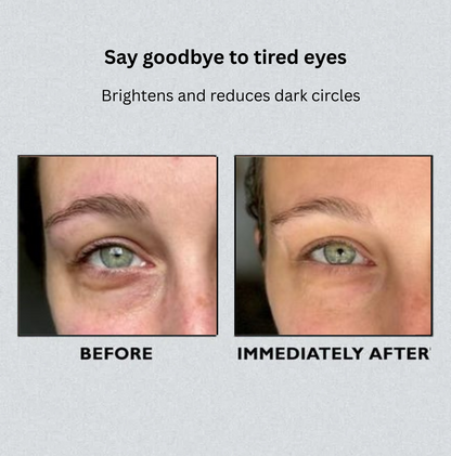 Instant Eye Lift Treatment