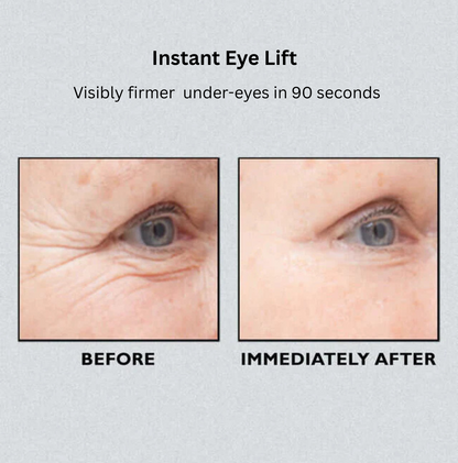 Instant Eye Lift Treatment