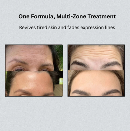 Instant Eye Lift Treatment