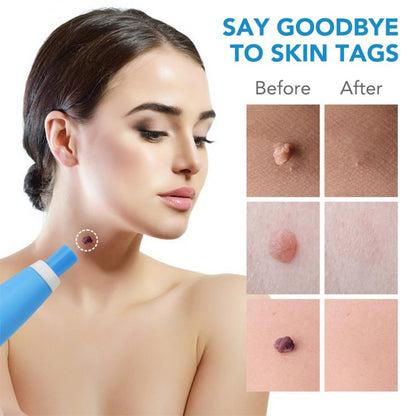 PAINLESS AUTO SKIN TAG REMOVER KIT